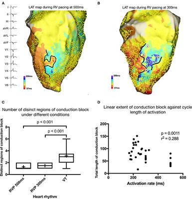 Late Gadolinium Enhancement Cardiovascular Magnetic Resonance Assessment of Substrate for Ventricular Tachycardia With Hemodynamic Compromise